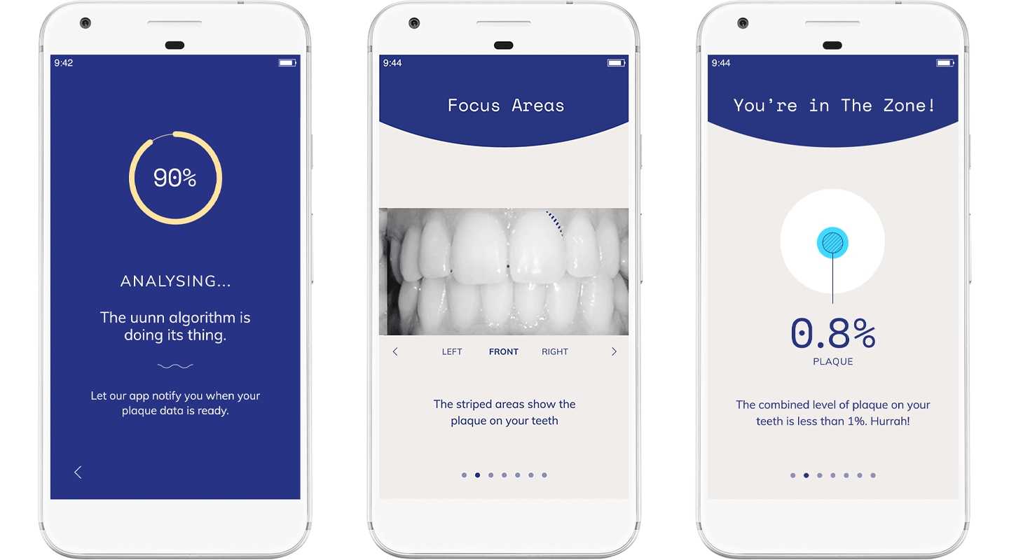 uunn app screen showing areas of the teeth containing plaque
