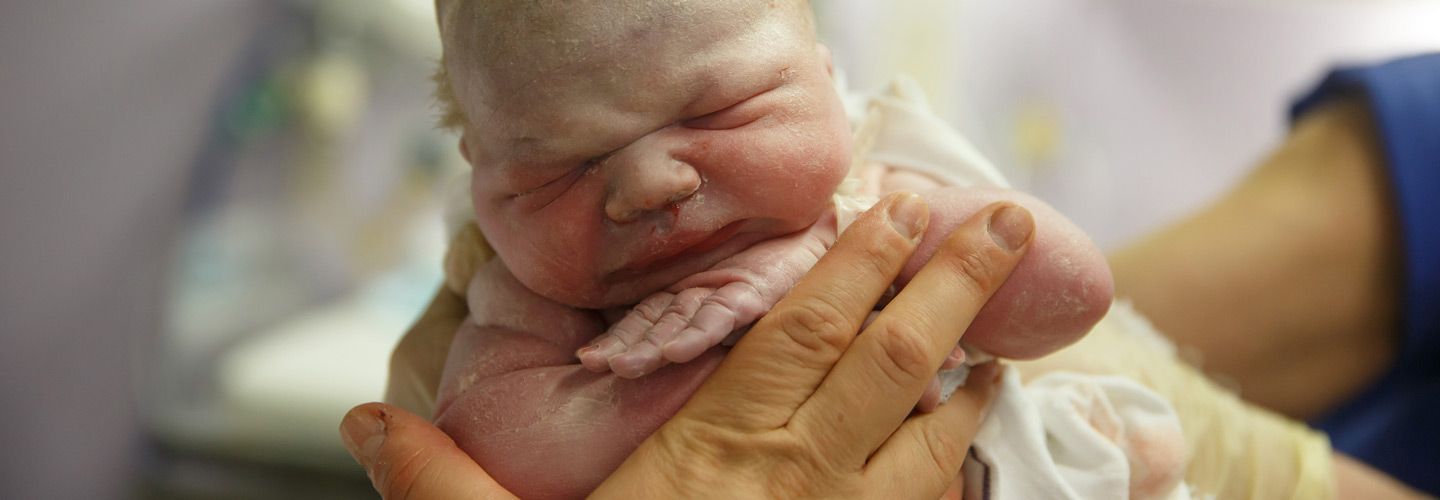 A newborn baby being held just after delivery